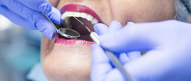 Best Emergency Dentist for Knocked-Out Tooth in Cambridge, MA